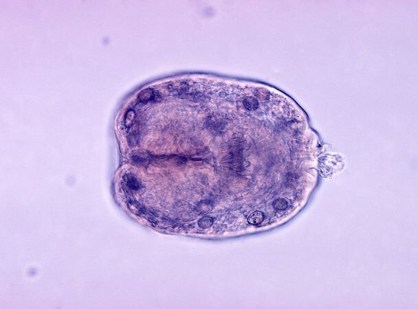 2. Echinococcus granulosus или цепень эхинококка