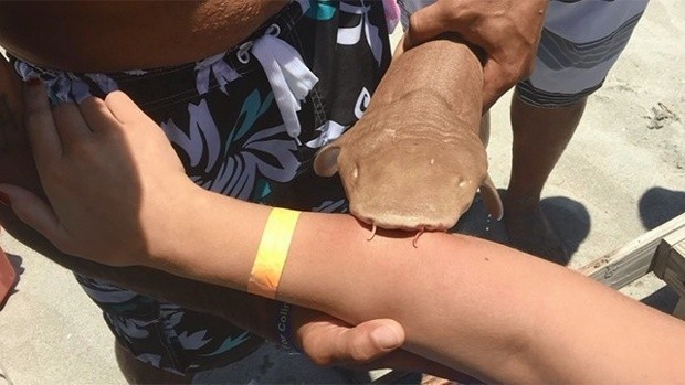 Вместе с акулой на руке 23-летняя девушка была вынуждена поехать в больницу