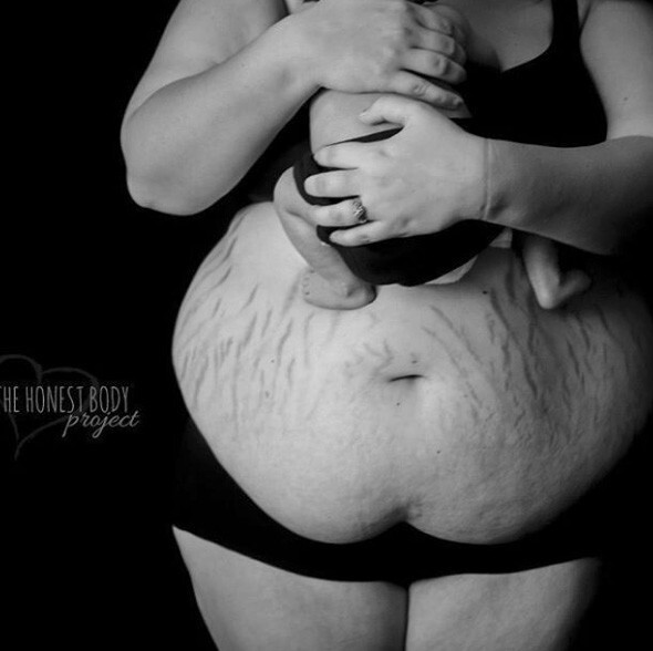 15 фото и историй женщин после беременности, которые мотивируют любить свое тело