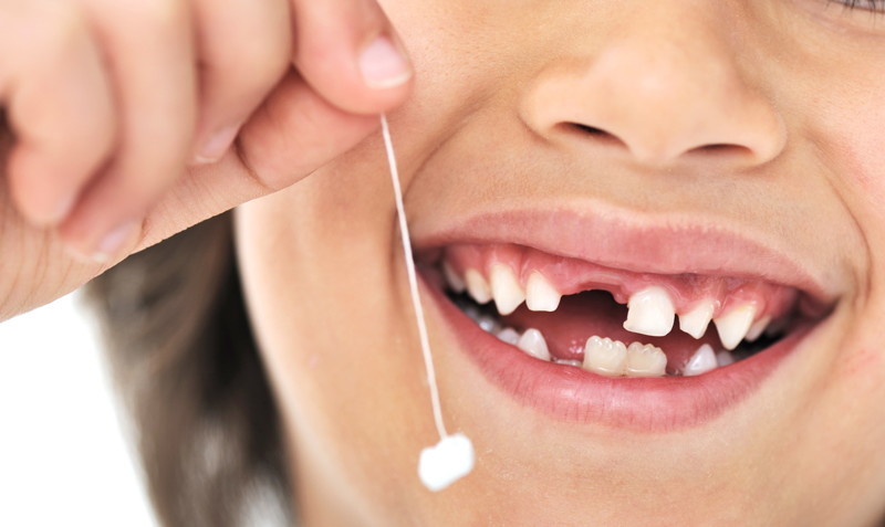 Как правильно удалять молочные зубы детям?