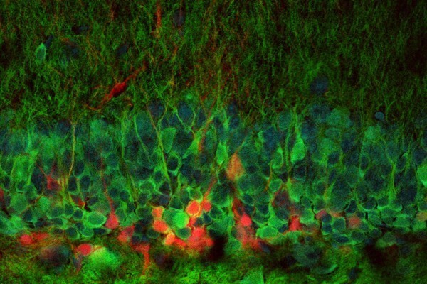 Миф и правда про восстановление нервных клеток