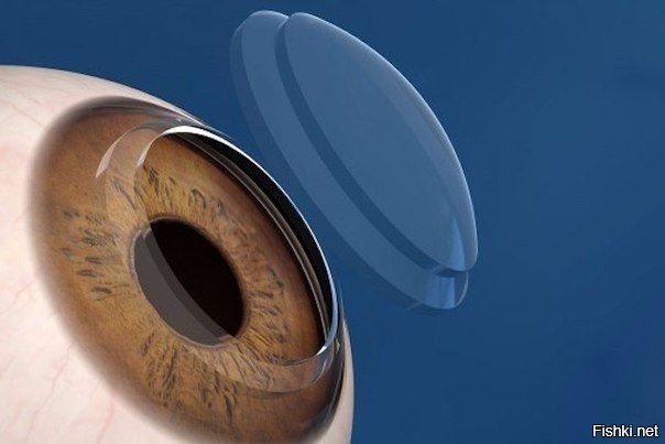 Роговица глаза – единственная часть человеческого тела, которая снабжается ки...