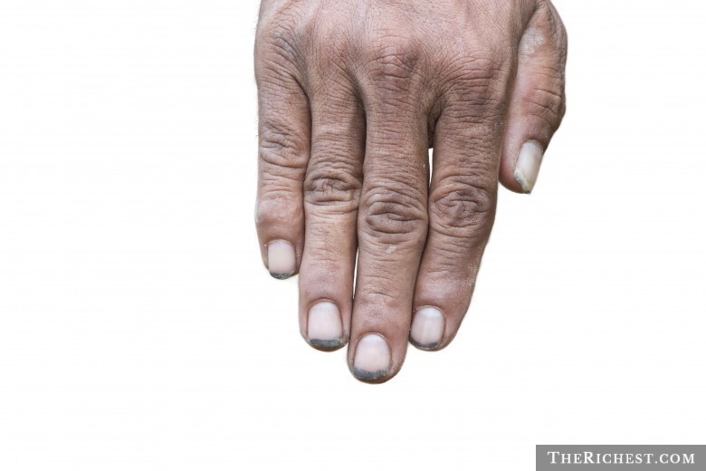 7. Безобразные ногти на руках