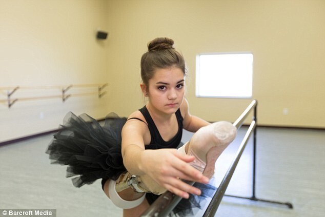 Вдохновляющий пример: девушка с протезом ноги стала прекрасной танцовщицей