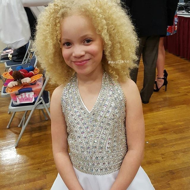 8-летняя девочка-альбинос делает карьеру в модельном бизнесе