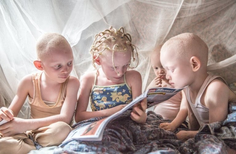 Невероятно: люди-альбиносы в Конго!