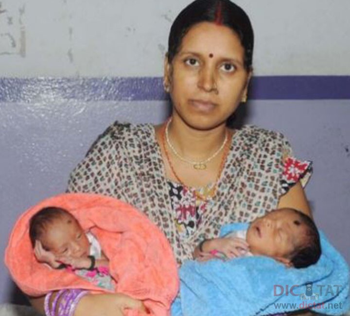 15. Женщина из Индии с двумя матками родила двоих детей