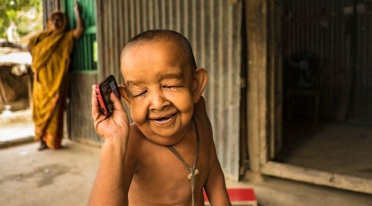 В Бангладеш живет 4-летний Бенджамин Баттон