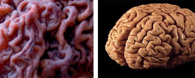 Если рассматривать грибницу как аналог мозга, который тоже проводит простейшие сигналы по миллионам клеток, создавая то, что мы считаем мышлением, то разумность гриба становится объяснимой.