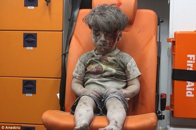 Эти снимки раненого пятилетнего сирийца потрясли мир!