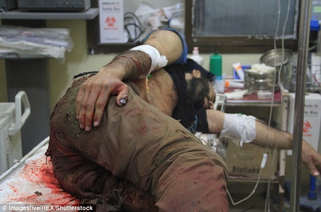Эти снимки раненого пятилетнего сирийца потрясли мир!