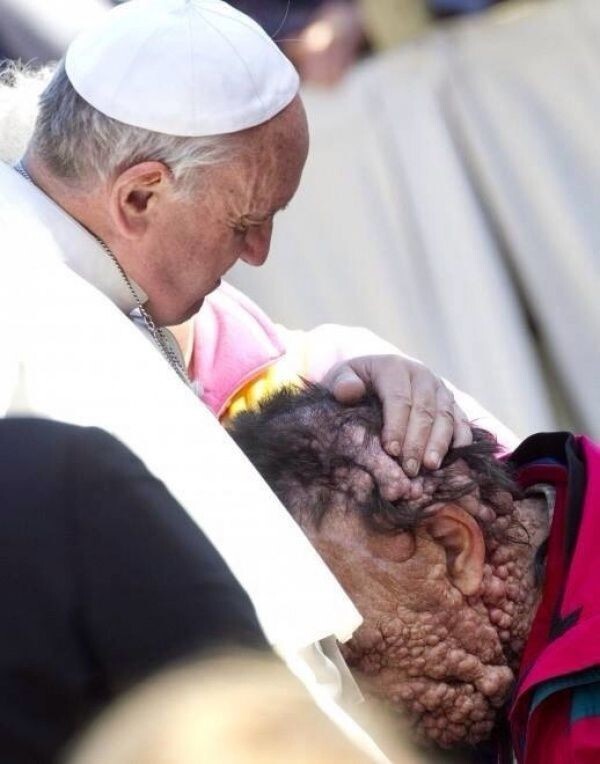 Папа римский Франциск обнимает изуродованного человека
