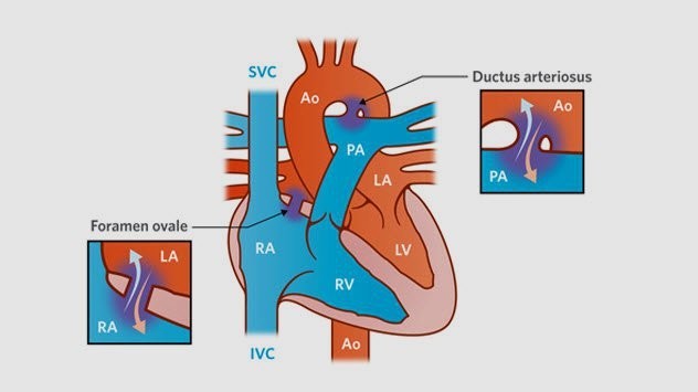 Организм новорожденных способен регенерировать часть повреждённого сердца 
