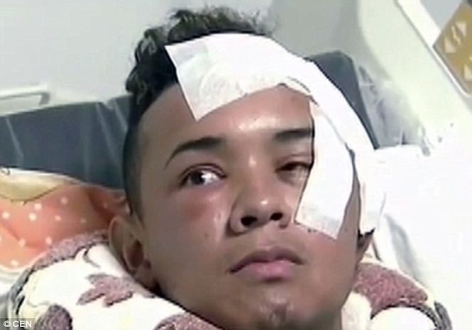 Колумбиец выжил после удара ножом в глаз