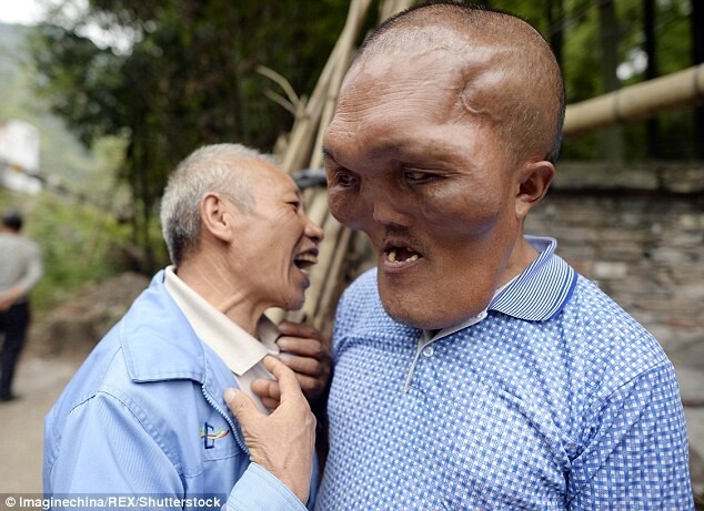 Похожий на пришельца китаец решил вернуть себе человеческую внешность