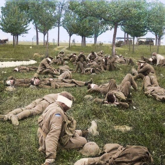 Австралийские солдаты, ослепшие в результате газовой атаки. Третья Французская республика, май 1918 года.