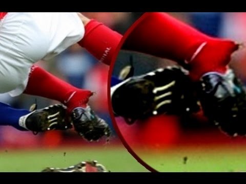 5 самых ужасных травм в футболе 