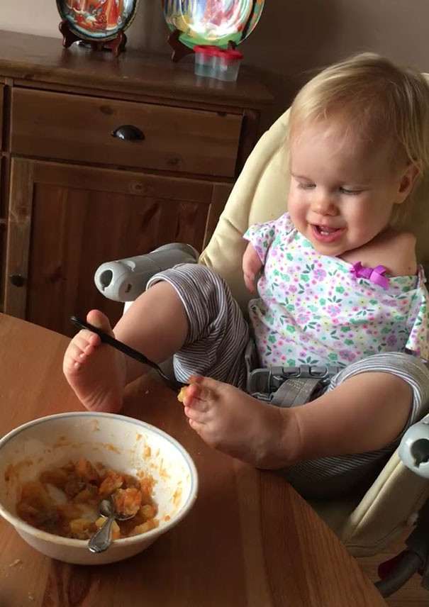 Эта маленькая девочка родилась без рук, но научилась кушать при помощи ног