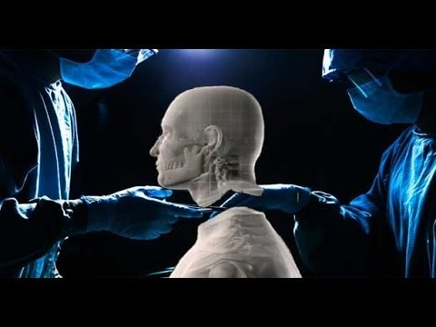 Впервые в мире хирургам удалось успешно пересадить голову 