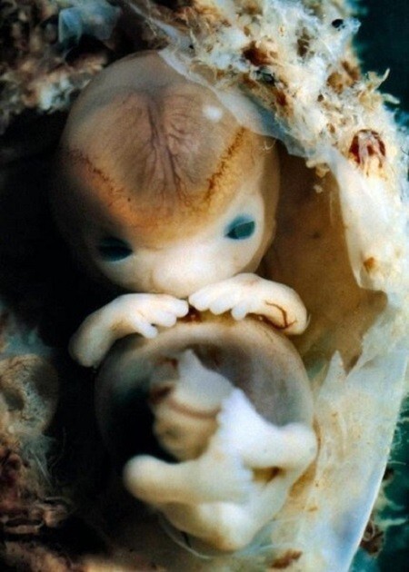 Эмбрион человека, которому всего семь недель. Его размер - 14 мм