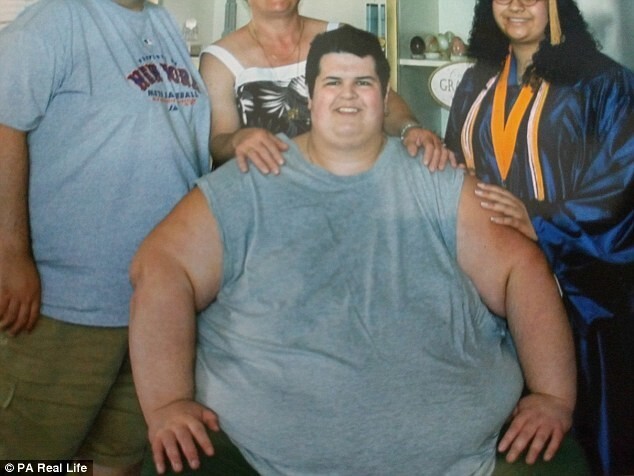 Мужчина весом более 320 кг сумел похудеть. Но повисла огромная проблема!