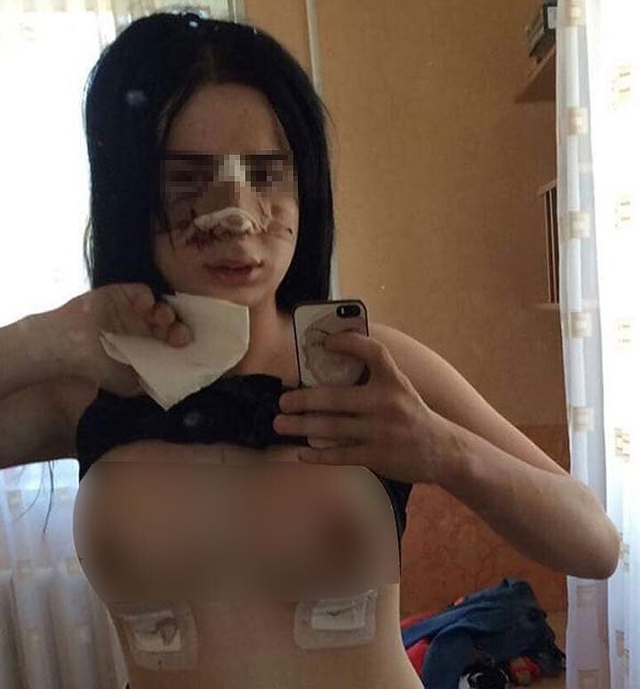 Дагестанец, сменивший пол, навлек на себя и на хирурга проклятие