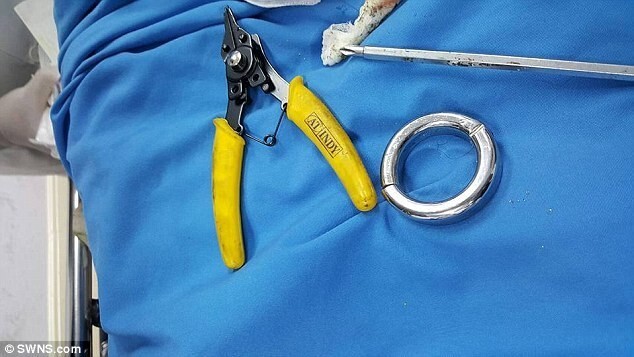 Таец сумел расстаться с секс-игрушкой лишь с помощью врачей и ножовки