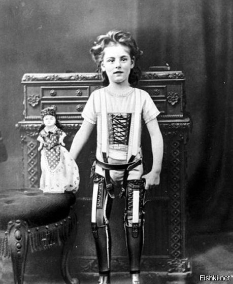 Ребенок и его искусственные ноги, 1898