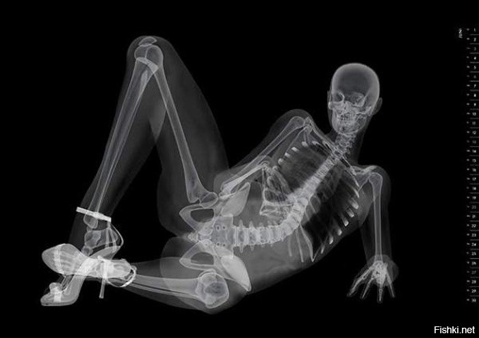 8 ноября 1895 физик Вильгельм Рентген открыл «рентгеновские лучи»