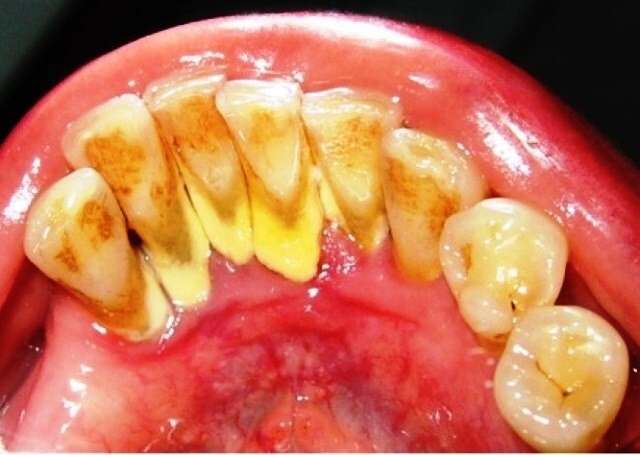 Органические компоненты зуба