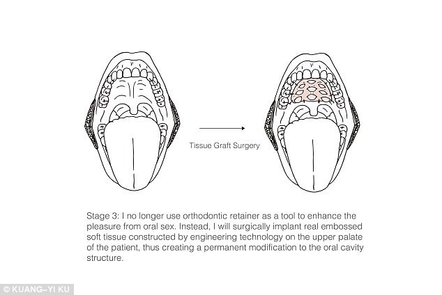 Стоматолог изобрел протез для улучшения оральных ласк
