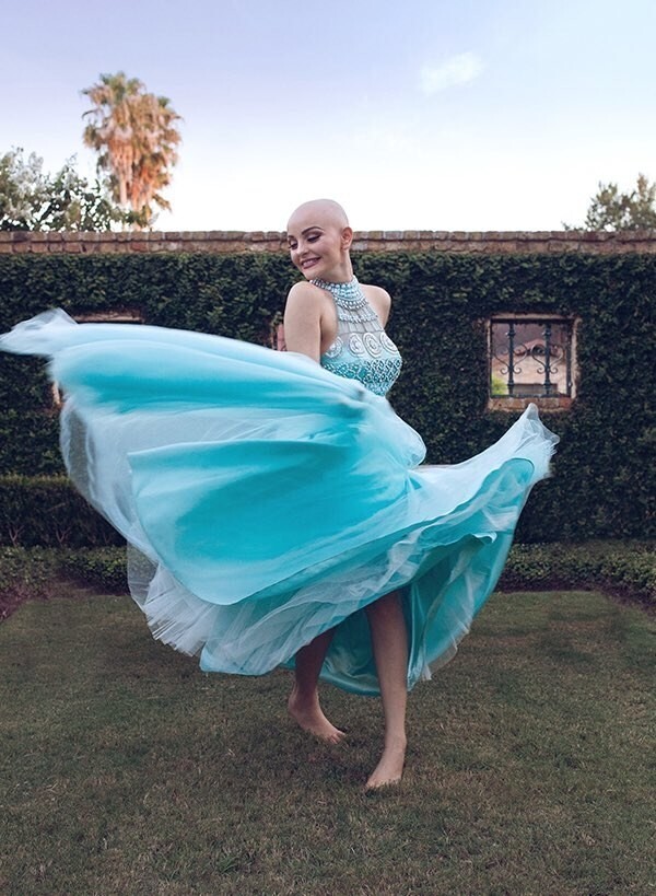 17-летняя школьница: «Рак не помешает мне быть принцессой»