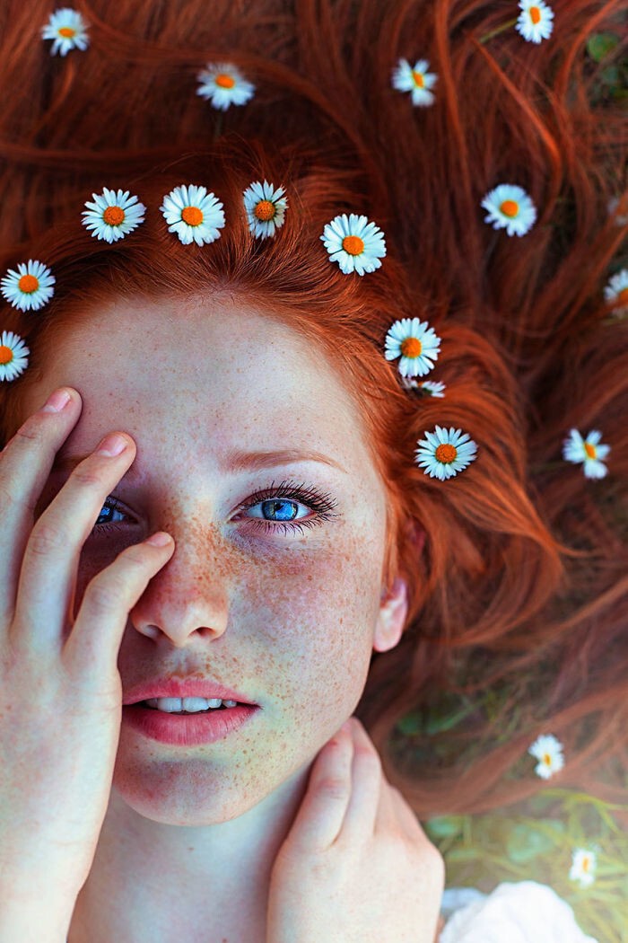 30 фотографий людей с веснушками, которые способны загипнотизировать своей уникальной красотой