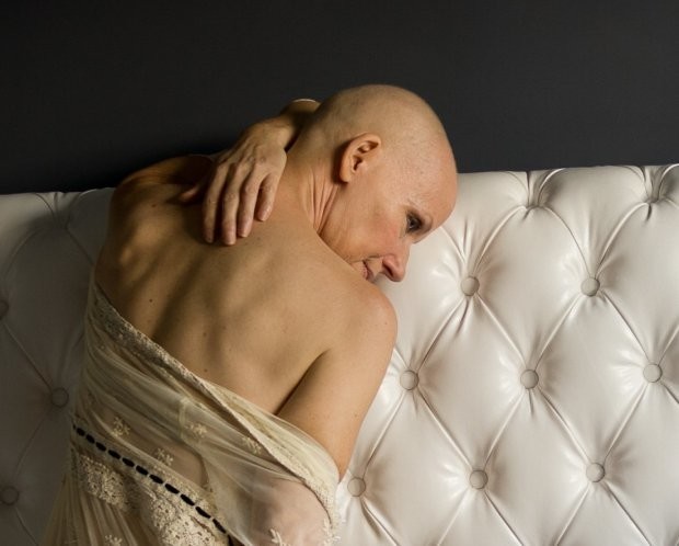 Восхитительная топлес-фотосессия женщины после двойной мастэктомии, которая отказалась от силиконовой груди 
