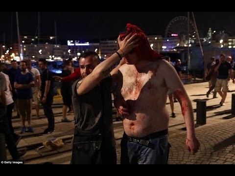 Столкновения болельщиков «Манчестер Юнайтед» и «Зари» в Одессе 