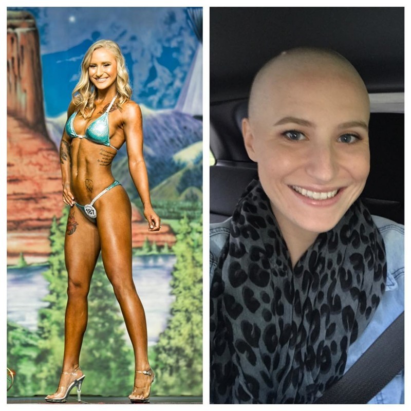 23-летняя культуристка борется с раком — и публикует это в Instagram