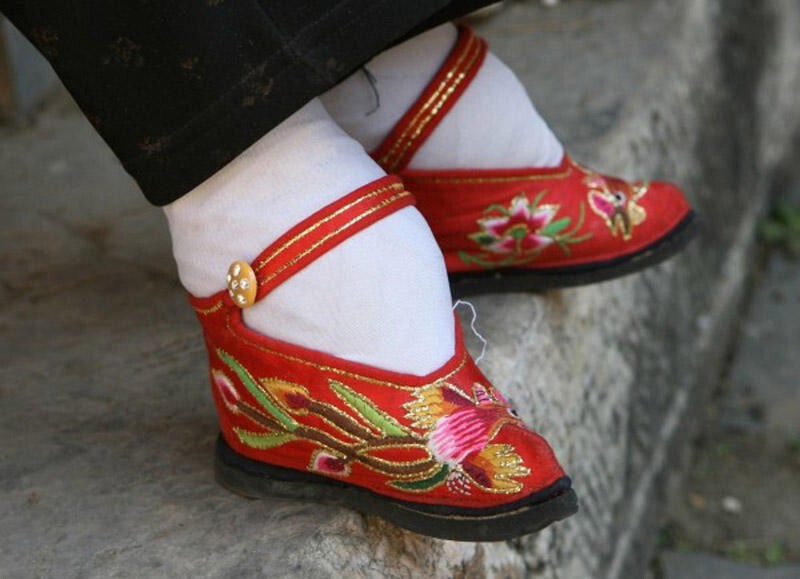 Несколько шокирующих снимков ног китайских «женщин-лотосов»   