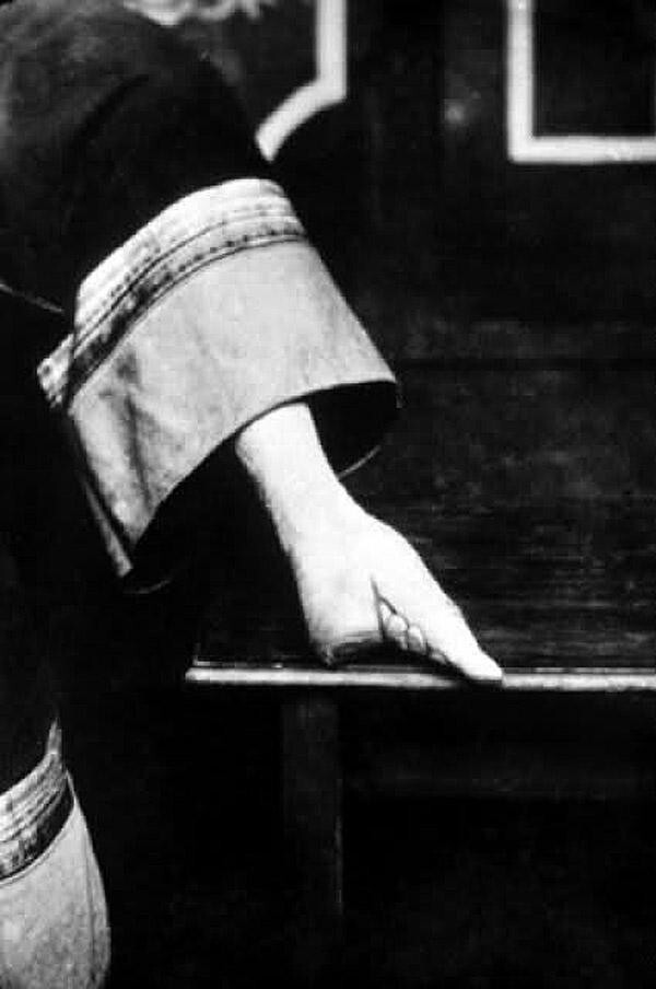 Несколько шокирующих снимков ног китайских «женщин-лотосов»   