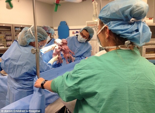 Женщина родила близнецов, которые появились на свет держась за руки
