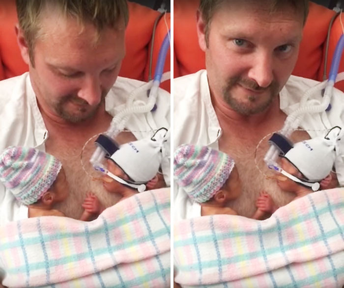 Недоношенные близнецы, держащиеся за руки, покорили интернет 