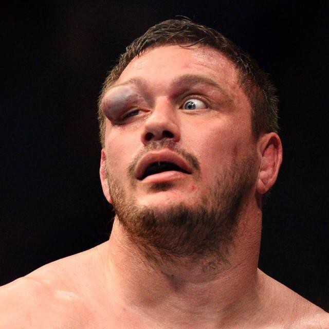 Самая отвратительная травма глаза в истории MMA