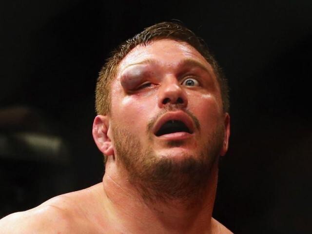 Самая отвратительная травма глаза в истории MMA