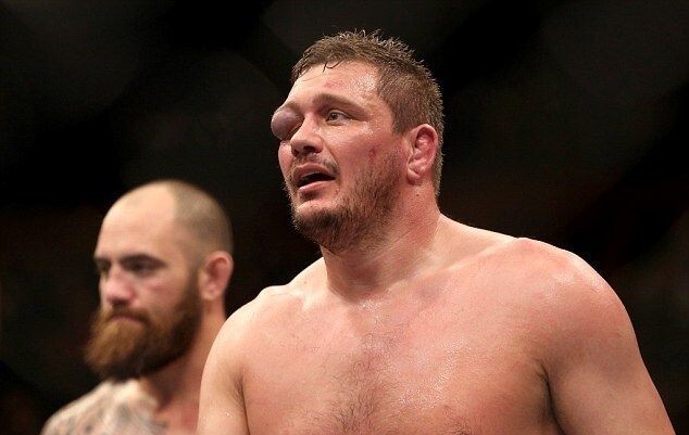 Самая отвратительная травма глаза в истории MMA