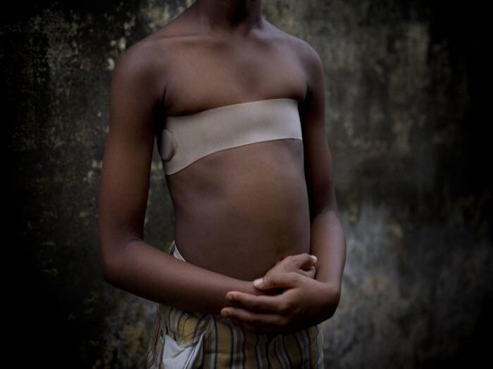 Шокирующая традиция Камеруна — утюжка груди