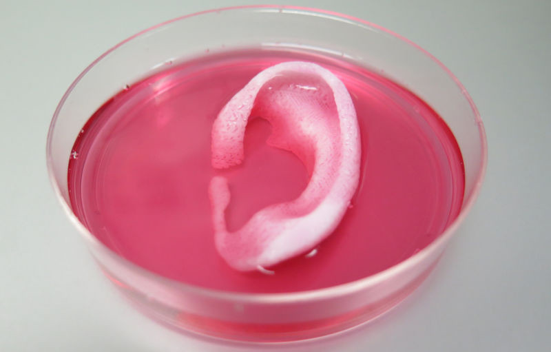 Учёные распечатали на 3D-принтере человеческое ухо для трансплантации