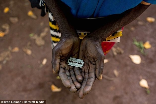 Молодая женщина из Африки жила с зашитыми половыми органами до 22 лет