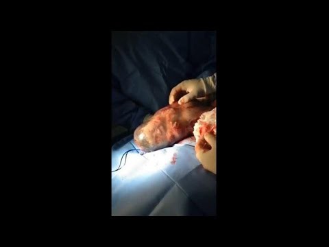 Уникальное видео: ребенок, родился в амниотическом мешке 