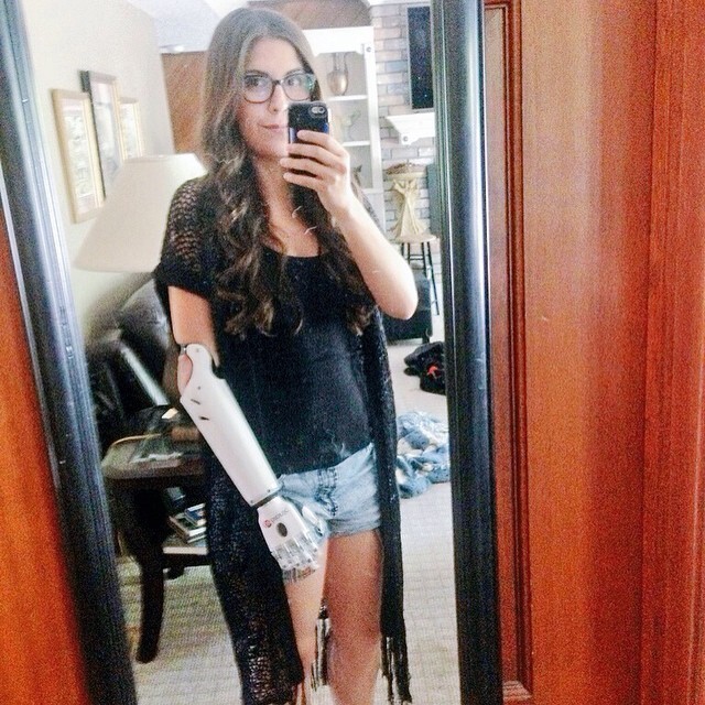 Энджел Гиуффриа единственная в мире актриса с бионическим протезом