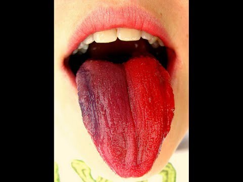 Кроваво-красный язык