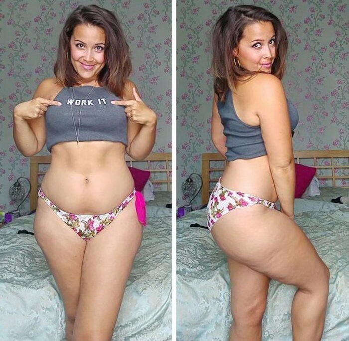 Девушка едва не умершая от анорексии набрала вес и публикует свои фото в бикини, чтобы помочь другим